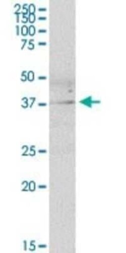 DUSP11 Antibody, Novus Biologicals 0.05 mg | Buy Online | Novus Biologicals | Fisher Scientific