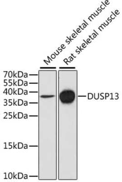 DUSP13 Antibody - Azide and BSA Free, Novus Biologicals:Antibodies:Primary