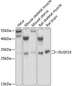 DUSP19 Antibody - BSA Free, Novus Biologicals:Antibodies:Primary Antibodies