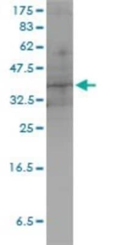 DUSP4 Antibody (3D6-G6), Novus Biologicals 0.1 mg | Buy Online | Novus Biologicals | Fisher Scientific