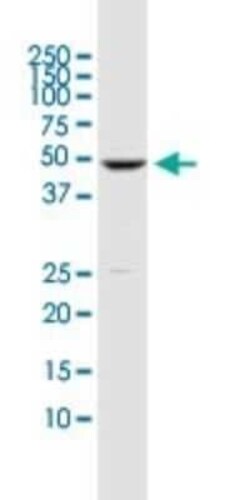 DUSP5 Antibody (2F3), Novus Biologicals 0.1 mg | Buy Online | Novus Biologicals | Fisher Scientific