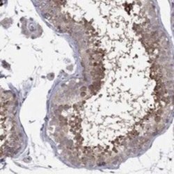 DUSP7 Rabbit anti-Human, Polyclonal, Novus Biologicals:Antibodies:Primary