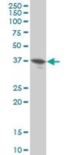 DUSP9 Antibody (2E3), Novus Biologicals 0.1 mg, Unconjugated:Antibodies,