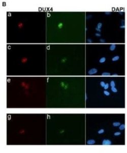 DUX4 Antibody (P4H2) - Azide and BSA Free, Novus Biologicals 0.1 mL; Unconjugated:Antibodies,
