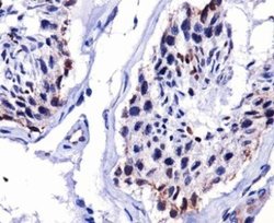 DUX4 Antibody (P4H2) - Azide and BSA Free, Novus Biologicals 0.1 mL; Unconjugated:Antibodies,