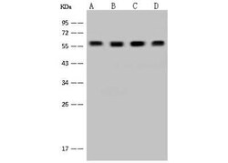 DYNC1LI1 Antibody, Novus Biologicals 100 &mu;g, Unconjugated:Antibodies,