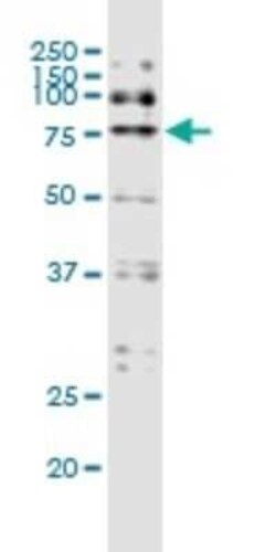 DYRK1A Antibody (7D10), Novus Biologicals 0.1 mg, Unconjugated:Antibodies,