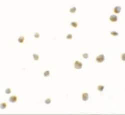 DYRK2 Antibody - BSA Free, Novus Biologicals:Anticorps:Anticorps primaires