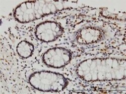 DYRK3 Antibody (3E10), Novus Biologicals 0.1 mg | Buy Online | Novus Biologicals | Fisher Scientific
