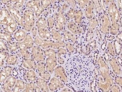 DZIP1 Antibody, Novus Biologicals 100 &mu;g, Unconjugated:Antibodies, Polyclonal