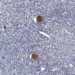 Dact1 Rabbit anti-Human, Polyclonal, Novus Biologicals 25 &mu;g; Unconjugated:Antibodies,