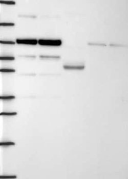Dact1 Rabbit anti-Human, Polyclonal, Novus Biologicals 25 &mu;g; Unconjugated:Antibodies,