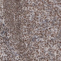 Daxx Antibody (CL3580), Novus Biologicals 100&mu;L:Antibodies, Monoclonal