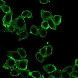 Daxx Antibody (PCRP-DAXX-8C2) - Azide and BSA Free, Novus Biologicals 100