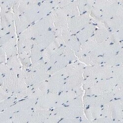 Daxx Antibody, Novus Biologicals 0.1 mL; Unconjugated:Antibodies, Polyclonal