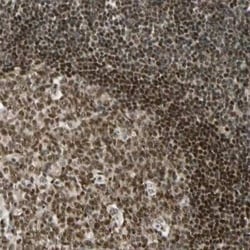 Daxx Antibody, Novus Biologicals 0.1 mL; Unconjugated:Antibodies, Polyclonal