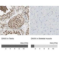 Daxx Antibody, Novus Biologicals 0.1 mL; Unconjugated:Antibodies, Polyclonal