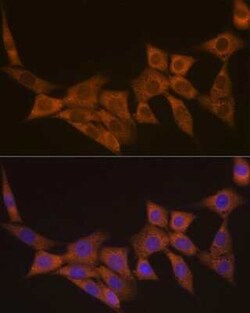 Dcp1a Rabbit anti-Human, Mouse, Clone: 7Q8Q6, Novus Biologicals 100 &mu;g;