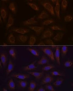 Dcp1a Rabbit anti-Human, Mouse, Clone: 7Q8Q6, Novus Biologicals 100 &mu;g;