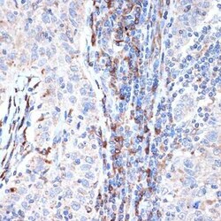 Dcp1a Rabbit anti-Human, Mouse, Clone: 7Q8Q6, Novus Biologicals 100 &mu;g;