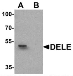 Death Ligand Signal Enhancer Antibody - BSA Free, Novus Biologicals 0.1