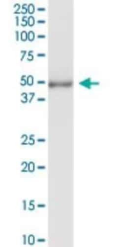 Delta 1 Tubulin Antibody, Novus Biologicals 0.1 mg | Buy Online | Novus Biologicals | Fisher Scientific