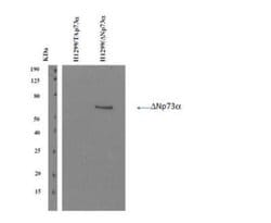 Delta Np73 Antibody (DNp73-1.1) - BSA Free, Novus Biologicals 0.1 mg; Unconjugated:Antibodies,