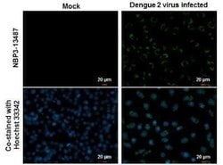 Dengue Virus 2 Envelope Antibody (GT214), Novus Biologicals 100 &mu;g;