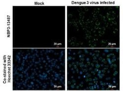 Dengue Virus 2 Envelope Antibody (GT214), Novus Biologicals 100 &mu;g;