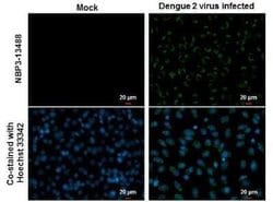 Dengue Virus 2 Envelope Antibody (GT643), Novus Biologicals 100 &mu;g | Buy Online | Novus Biologicals | Fisher Scientific