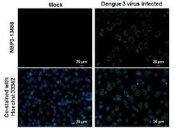 Dengue Virus 2 Envelope Antibody (GT643), Novus Biologicals 100 &mu;g | Buy Online | Novus Biologicals | Fisher Scientific