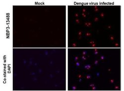 Dengue Virus 2 Envelope Antibody (GT643), Novus Biologicals 100 &mu;g | Buy Online | Novus Biologicals | Fisher Scientific