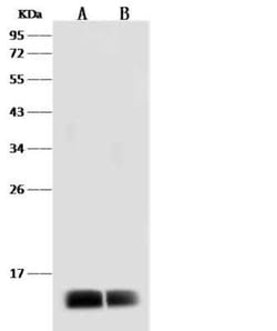 Dengue Virus 2 Envelope Antibody, Novus Biologicals 100 &mu;g; Unconjugated:Antibodies,