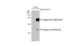 Dengue Virus 2 premembrane (prM) Envelope Antibody, Novus Biologicals 100 &mu;g | Buy Online | Bio-Techne | Fisher Scientific