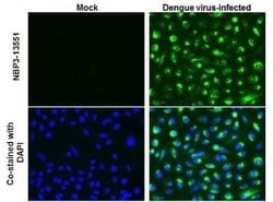 Dengue Virus Capsid Protein Antibody (GT574), Novus Biologicals 100 &mu;g | Buy Online | Novus Biologicals | Fisher Scientific