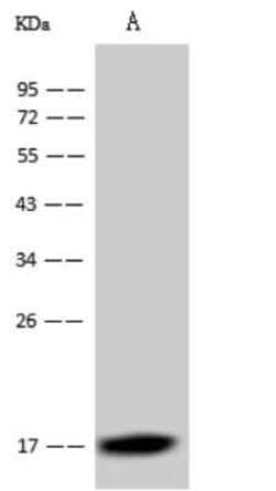 Dengue Virus Capsid Protein Antibody (05), Novus Biologicals 100 &mu;g | Buy Online | Novus Biologicals | Fisher Scientific