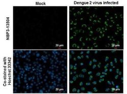 Dengue Virus NS1 protein Antibody (GT1061), Novus Biologicals 100 &mu;g | Buy Online | Novus Biologicals | Fisher Scientific