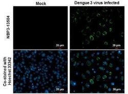 Dengue Virus NS1 protein Antibody (GT1061), Novus Biologicals 100 &mu;g | Buy Online | Novus Biologicals | Fisher Scientific