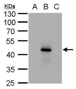 Dengue Virus NS1 protein Antibody (GT1061), Novus Biologicals 100 &mu;g | Buy Online | Novus Biologicals | Fisher Scientific