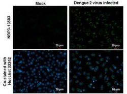 Dengue Virus NS1 protein Antibody (GT4212), Novus Biologicals 100 &mu;g | Buy Online | Novus Biologicals | Fisher Scientific