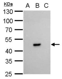 Dengue Virus NS1 protein Antibody (GT4212), Novus Biologicals 100 &mu;g | Buy Online | Novus Biologicals | Fisher Scientific