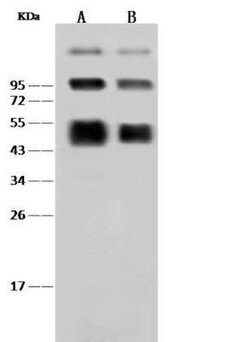 Dengue Virus NS1 protein Antibody, Novus Biologicals 50 &mu;g; Unconjugated:Antikroppar