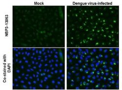 Dengue Virus NS4A Antibody, Novus Biologicals 100 &mu;g | Buy Online | Bio-Techne | Fisher Scientific