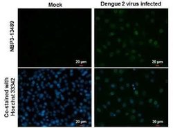 Dengue Virus NS5 Antibody (GT353), Novus Biologicals 100 &mu;g | Buy Online | Novus Biologicals | Fisher Scientific