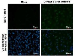 Dengue Virus NS5 Antibody (GT353), Novus Biologicals 100 &mu;g | Buy Online | Novus Biologicals | Fisher Scientific
