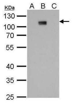 Dengue Virus NS5 Antibody (GT353), Novus Biologicals 100 &mu;g | Buy Online | Novus Biologicals | Fisher Scientific