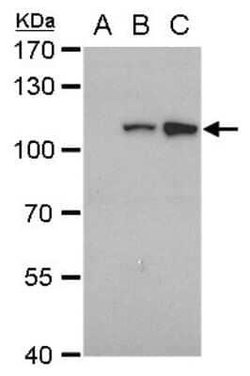 Dengue Virus NS5 Antibody (GT353), Novus Biologicals 100 &mu;g | Buy Online | Novus Biologicals | Fisher Scientific