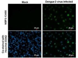 Dengue Virus NS5 Antibody (GT361), Novus Biologicals 100 &mu;g | Buy Online | Novus Biologicals | Fisher Scientific