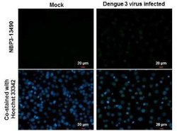 Dengue Virus NS5 Antibody (GT361), Novus Biologicals 100 &mu;g | Buy Online | Novus Biologicals | Fisher Scientific