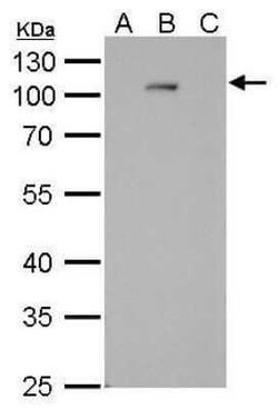 Dengue Virus NS5 Antibody (GT361), Novus Biologicals 100 &mu;g | Buy Online | Novus Biologicals | Fisher Scientific